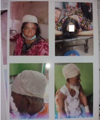 সিরাজদিখানে তুচ্ছ ঘটনায় একই পরিবারে ৮ জনকে কুপিয়ে জখম