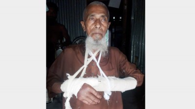 ভরণপোষণ চাওয়ায় বাবার দু’হাত ভেঙ্গে দিল পাষণ্ড ছেলে! ভরণপোষণ চাওয়ায় বাবার দু’হাত ভেঙ্গে দিল পাষণ্ড ছেলে!