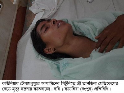 কাউনিয়ায় টেপামধুপুরে স্বামীর নির্যাতনে স্ত্রী হাসপাতালে