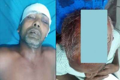 লৌহজংয়ে বাড়ির সীমানা নিয়ে বিরোধে দুই ভাইকে কুপিয়ে জখম, একজন কোমায় লৌহজংয়ে বাড়ির সীমানা নিয়ে বিরোধে দুই ভাইকে কুপিয়ে জখম, একজন কোমায়
