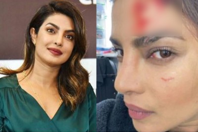 সিটাডেল ছবির অ্যাকশন দৃশ্যের শুট চলাকালীন চোট পেলেন প্রিয়াঙ্কা