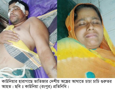 কাউনিয়ায় ভাতিজার ধারালো অস্ত্রের আঘাতে চাচা-চাচি গুরুতর আহত