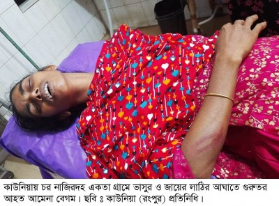হারাগাছে চর নাজিরদহে ভাসুর ও জায়ের লাঠির আঘাতে মহিলা আহত