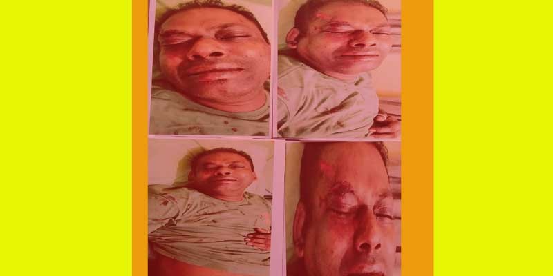 সিরাজদিখানে তুচ্ছ ঘটনায় এক ব্যক্তিকে পিটিয়ে জখম, থানায় অভিযোগ সিরাজদিখানে তুচ্ছ ঘটনায় এক ব্যক্তিকে পিটিয়ে জখম, থানায় অভিযোগ