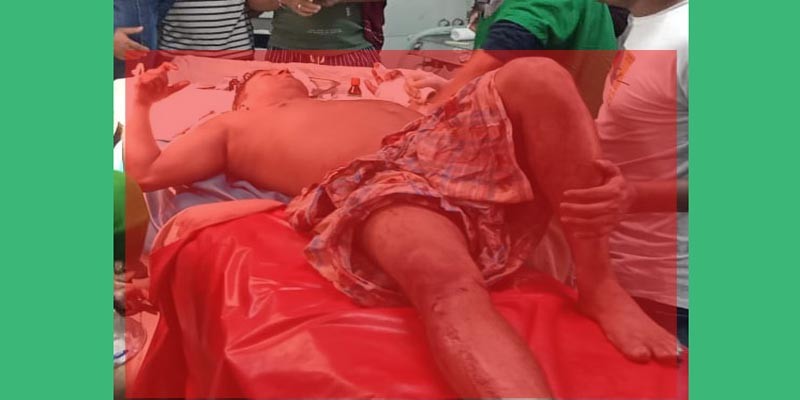 বগুড়ায় প্রকাশ্য দিবালোকে বাড়িতে ঢুকে স্বেচ্ছাসেবক দল নেতা হোসেনকে এলোপাথারি ছুরিকাঘাত বগুড়ায় প্রকাশ্য দিবালোকে বাড়িতে ঢুকে স্বেচ্ছাসেবক দল নেতা হোসেনকে এলোপাথারি ছুরিকাঘাত