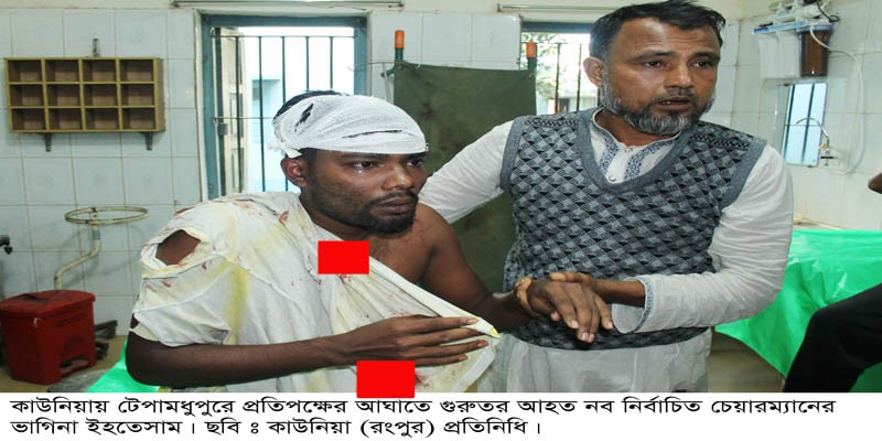 কাউনিয়ার টেপামধুপুরে নির্বাচন পরর্বতী সহিংসতায় আহত এক কাউনিয়ার টেপামধুপুরে নির্বাচন পরর্বতী সহিংসতায় আহত এক
