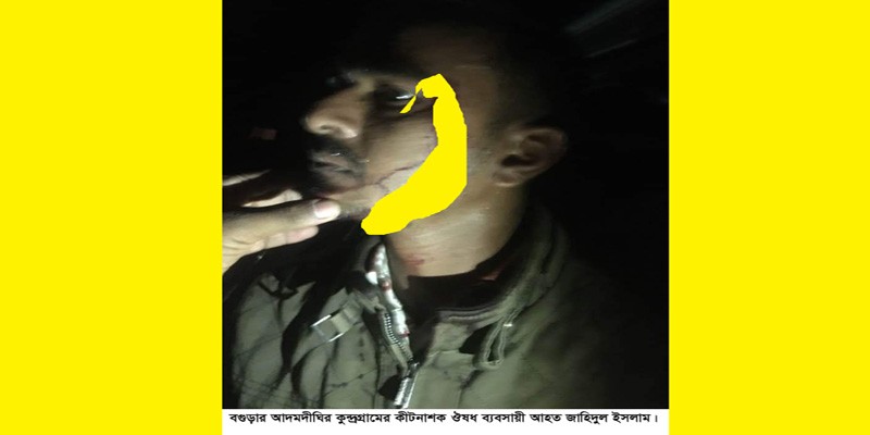 আদমদীঘিতে ব্যবসায়ীর পথরোধে মারপিটে ৫ লাখ টাকা ছিনতাইয়ের অভিযোগ আদমদীঘিতে ব্যবসায়ীর পথরোধে মারপিটে ৫ লাখ টাকা ছিনতাইয়ের অভিযোগ