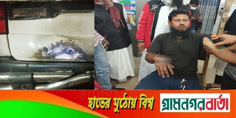 অ্যাম্বুলেন্সে অক্সিজেন সিলিন্ডার বিস্ফোরণ, দগ্ধ ৩ অ্যাম্বুলেন্সে অক্সিজেন সিলিন্ডার বিস্ফোরণ, দগ্ধ ৩