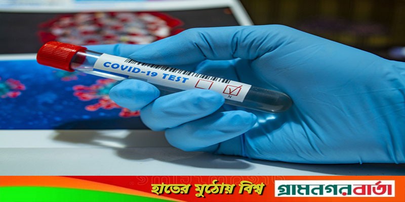 বাংলাদেশে আসতে লাগবে না কোভিড পরীক্ষা বাংলাদেশে আসতে লাগবে না কোভিড পরীক্ষা
