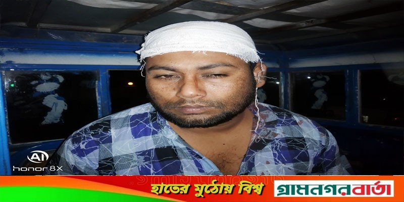 শ্রীনগরে মেলায় বেলুন ব্যবসায়ীর উপর সন্ত্রাসী হামলা, আহত-২ শ্রীনগরে মেলায় বেলুন ব্যবসায়ীর উপর সন্ত্রাসী হামলা, আহত-২