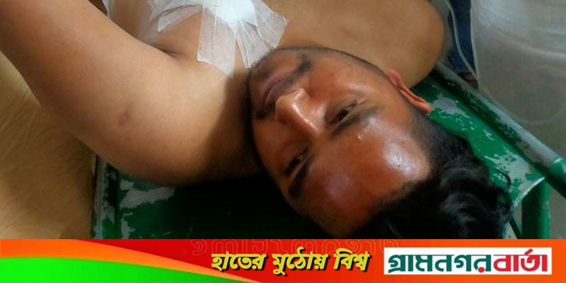নামাজে যাওয়ার পথে দুর্বৃত্তের গুলিতে আহত যুবক নামাজে যাওয়ার পথে দুর্বৃত্তের গুলিতে আহত যুবক