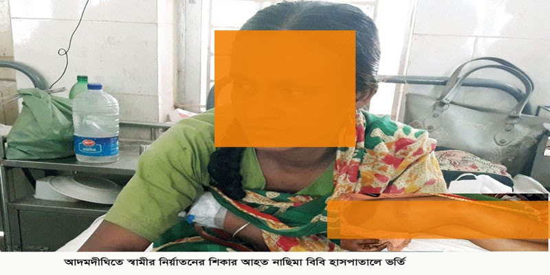 আদমদীঘিতে মধ্যযুগীয় কায়দায় স্ত্রীকে নির্যাতন আদমদীঘিতে মধ্যযুগীয় কায়দায় স্ত্রীকে নির্যাতন