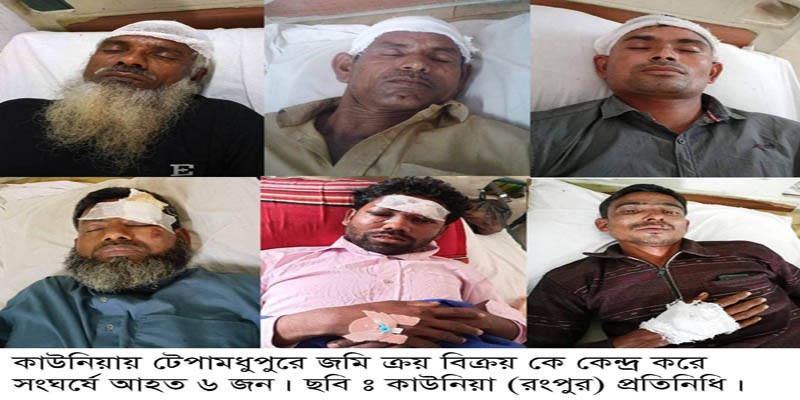কাউনিয়ায় টেপামধুপুরে জমি ক্রয় নিয়ে ক্রেতা-বিক্রেতার সংঘর্ষে আহত ৬ কাউনিয়ায় টেপামধুপুরে জমি ক্রয় নিয়ে ক্রেতা-বিক্রেতার সংঘর্ষে আহত ৬