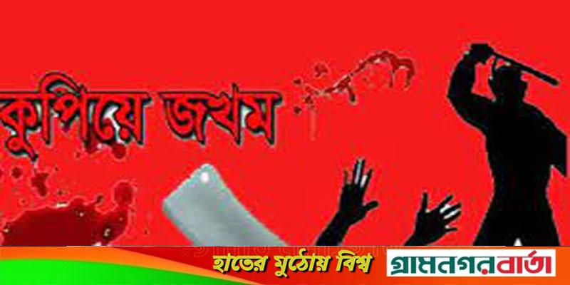 শ্রীনগরে মাদক বিক্রিতে বাধা দেয়ায় ভাইকে কুপিয়ে জখম শ্রীনগরে মাদক বিক্রিতে বাধা দেয়ায় ভাইকে কুপিয়ে জখম