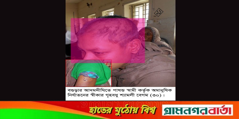 আদমদীঘিতে স্ত্রী’কে অমানুষিক নির্যাতনের পর মাথা ন্যাড়া করল পাষন্ড স্বামী আদমদীঘিতে স্ত্রী’কে অমানুষিক নির্যাতনের পর মাথা ন্যাড়া করল পাষন্ড স্বামী