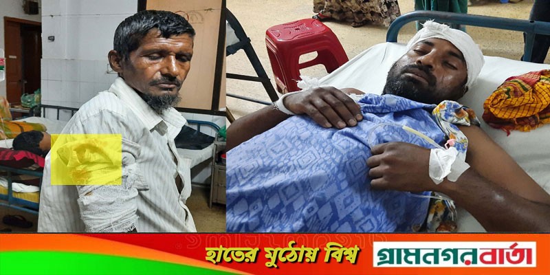 বাগেরহাটে প্রতিপক্ষের হামলায় বাবা-মা-ছেলেসহ আহত ৪ বাগেরহাটে প্রতিপক্ষের হামলায় বাবা-মা-ছেলেসহ আহত ৪