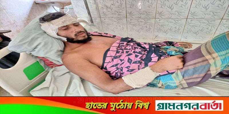 সুন্দরবনে বাঘের সাথে ধস্তাধস্তি করে ফিরে আসলেন জেলে আবু সালেহ! সুন্দরবনে বাঘের সাথে ধস্তাধস্তি করে ফিরে আসলেন জেলে আবু সালেহ!