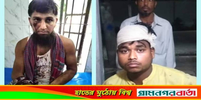 মুন্সীগঞ্জের টঙ্গীবাড়ীতে পূর্বশত্রুতার জের ধরে হাফেজসহ ২ জনকে কুপিয়ে জখম, আটক ২ মুন্সীগঞ্জের টঙ্গীবাড়ীতে পূর্বশত্রুতার জের ধরে হাফেজসহ ২ জনকে কুপিয়ে জখম, আটক ২