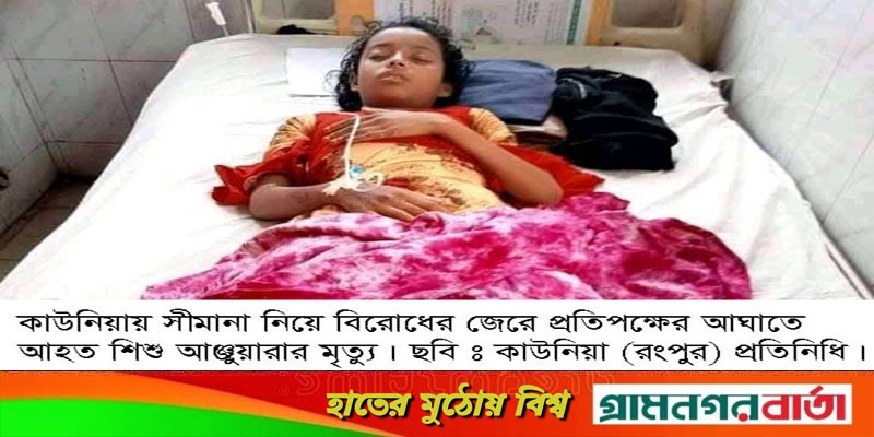 টেপামধুপুরের বিশ্বনাথ গ্রামে প্রতিপক্ষের আঘাতে আহত শিশুটির মৃত্যু টেপামধুপুরের বিশ্বনাথ গ্রামে প্রতিপক্ষের আঘাতে আহত শিশুটির মৃত্যু