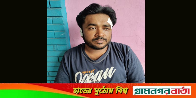 ভাঙ্গায় পূর্ব শত্রুতার জেরে সাংবাদিকের উপর হামলা ভাঙ্গায় পূর্ব শত্রুতার জেরে সাংবাদিকের উপর হামলা