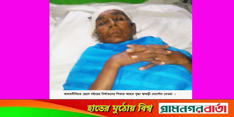 আদমদীঘিতে ছেলে বউয়ের নির্যাতনের শিকার বৃদ্ধা শ্বাশুড়ী হাসপাতালে আদমদীঘিতে ছেলে বউয়ের নির্যাতনের শিকার বৃদ্ধা শ্বাশুড়ী হাসপাতালে