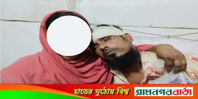 শিবগঞ্জে ব্যবসায়ীকে মারপিট থানায় অভিযোগ শিবগঞ্জে ব্যবসায়ীকে মারপিট থানায় অভিযোগ