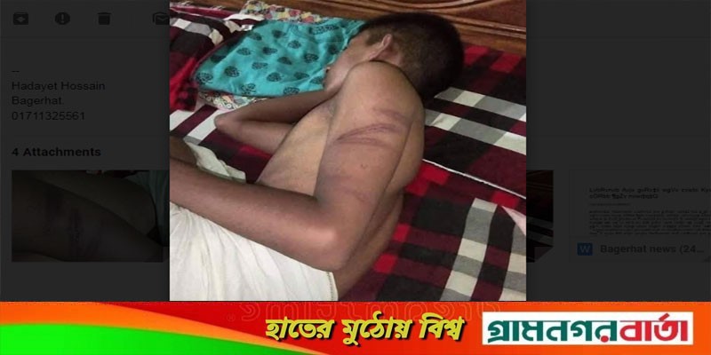 বাগেরহাটে মাদ্রাসা শিক্ষকের বিরুদ্ধে ছাত্র নির্যাতনের অভিযোগ বাগেরহাটে মাদ্রাসা শিক্ষকের বিরুদ্ধে ছাত্র নির্যাতনের অভিযোগ