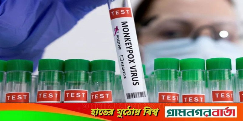 মাংকিপক্সের প্রতিরোধে গণটিকার প্রয়োজন নেই, তবে--: বিশ্ব স্বাস্থ্য সংস্থা মাংকিপক্সের প্রতিরোধে গণটিকার প্রয়োজন নেই, তবে--: বিশ্ব স্বাস্থ্য সংস্থা