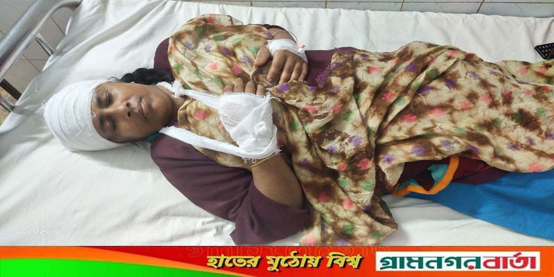 বাগেরহাটে প্রতিপক্ষের হামলায় মহিলা ইউপি সদস্য গুরুত্বর জখম বাগেরহাটে প্রতিপক্ষের হামলায় মহিলা ইউপি সদস্য গুরুত্বর জখম