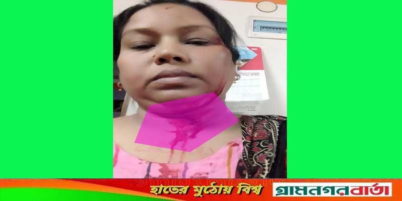 বাগেরহাটে প্রতিবেশীর ইটের আঘাতে নারী প্রভাষক আহত বাগেরহাটে প্রতিবেশীর ইটের আঘাতে নারী প্রভাষক আহত