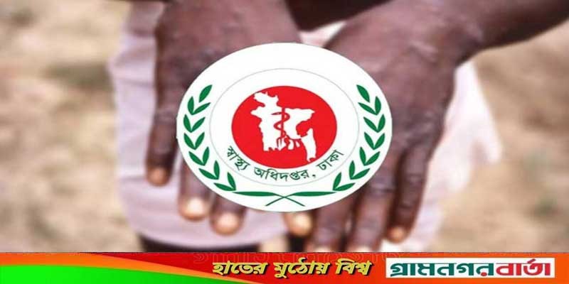 ঢাকায় আসা তুরস্কের নাগরিকের উপসর্গ মাঙ্কিপক্সের নয়: স্বাস্থ্য অধিদপ্তর ঢাকায় আসা তুরস্কের নাগরিকের উপসর্গ মাঙ্কিপক্সের নয়: স্বাস্থ্য অধিদপ্তর