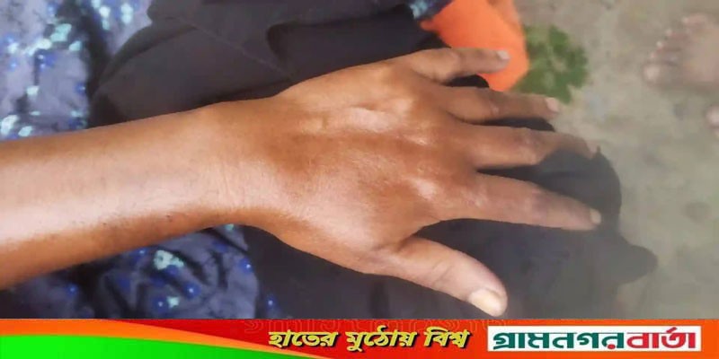 ফুটবল খেলার মাঠে সিনিয়র জুনিয়র দ্বন্দ্বে মারামারি আহত ছয় ফুটবল খেলার মাঠে সিনিয়র জুনিয়র দ্বন্দ্বে মারামারি আহত ছয়
