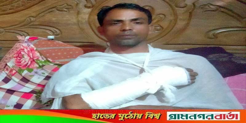 মুন্সীগঞ্জে সড়ক দুর্ঘটনায় সাংবাদিক মোস্তফা আহত মুন্সীগঞ্জে সড়ক দুর্ঘটনায় সাংবাদিক মোস্তফা আহত