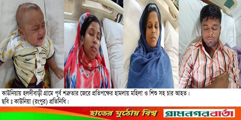 কাউনিয়ায় প্রতিপক্ষের হামলায় মহিলা-শিশুসহ চার জন আহত কাউনিয়ায় প্রতিপক্ষের হামলায় মহিলা-শিশুসহ চার জন আহত