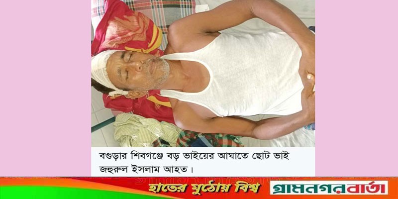 শিবগঞ্জে বড় ভাইয়ের আঘাতে ছোট ভাই আহত, থানায় অভিযোগ শিবগঞ্জে বড় ভাইয়ের আঘাতে ছোট ভাই আহত, থানায় অভিযোগ