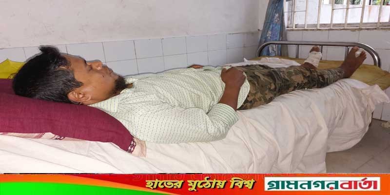 শ্রীপুরে জমি সংক্রন্ত জেরে সাংবাদিকসহ আহত ৪ শ্রীপুরে জমি সংক্রন্ত জেরে সাংবাদিকসহ আহত ৪