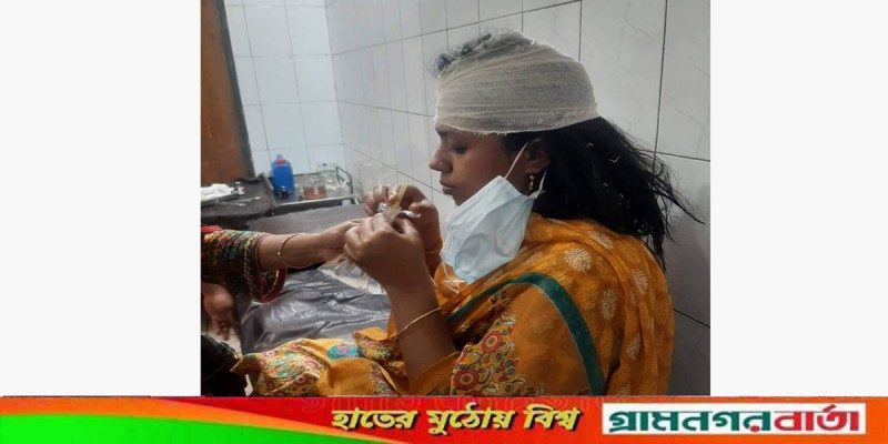 সিরাজদিখানে যৌতুকের জন্য স্ত্রীকে হত্যার চেষ্টা, থানায় অভিযোগ সিরাজদিখানে যৌতুকের জন্য স্ত্রীকে হত্যার চেষ্টা, থানায় অভিযোগ