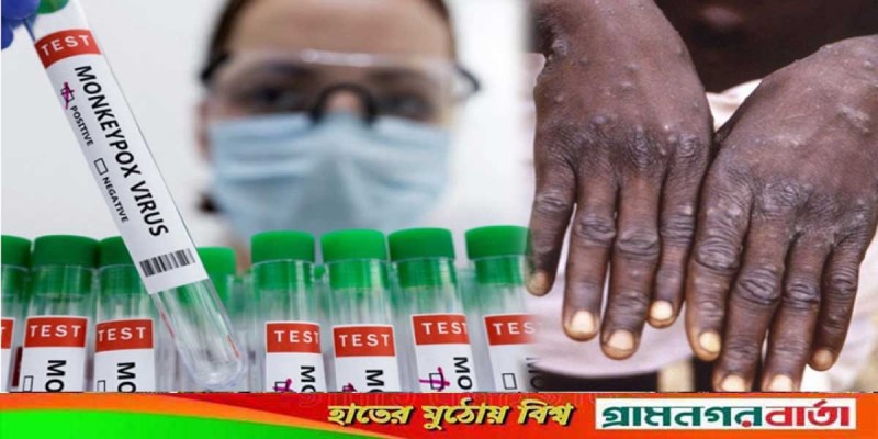 মাঙ্কিপক্সে থাবায় ভারতে প্রথম প্রাণহানি মাঙ্কিপক্সে থাবায় ভারতে প্রথম প্রাণহানি