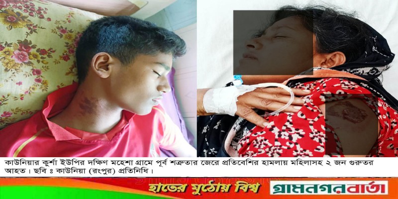 কাউনিয়ায় প্রতিবেশির মারপিটে মহিলাসহ দুইজন হাসপাতালে কাউনিয়ায় প্রতিবেশির মারপিটে মহিলাসহ দুইজন হাসপাতালে