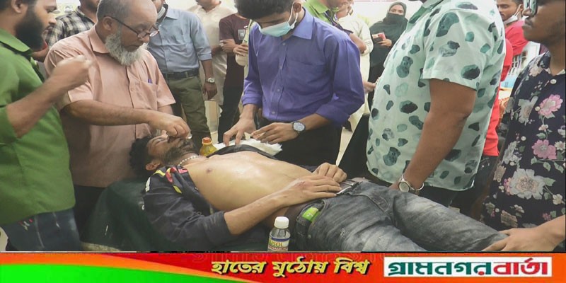 মাদারীপুরে কলেজছাত্রকে কুপিয়ে জখম মাদারীপুরে কলেজছাত্রকে কুপিয়ে জখম