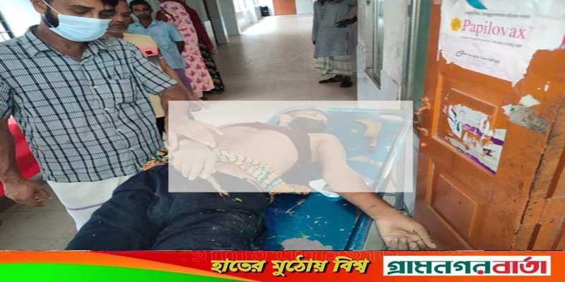 ঢাকা-মাওয়া এক্সপ্রেসওয়েতে ডাকাতি, পালানোর সময় ডাকাতের মৃত্যু ঢাকা-মাওয়া এক্সপ্রেসওয়েতে ডাকাতি, পালানোর সময় ডাকাতের মৃত্যু
