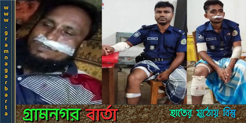ডাকাতের গুলিতে পুলিশ সহ আহত চার জন ডাকাতের গুলিতে পুলিশ সহ আহত চার জন