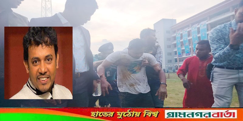 পুলিশের অনুষ্ঠানে বেলুন বিস্ফোরণ, কৌতুক অভিনেতা রনিসহ দগ্ধ ৫ পুলিশের অনুষ্ঠানে বেলুন বিস্ফোরণ, কৌতুক অভিনেতা রনিসহ দগ্ধ ৫