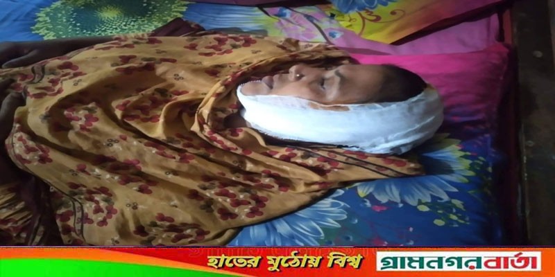 আদালতের নিষেধাজ্ঞা উপেক্ষা করে বসত বাড়ীতে প্রবেশ, মা-মেয়েকে পিটিয়ে জখম আদালতের নিষেধাজ্ঞা উপেক্ষা করে বসত বাড়ীতে প্রবেশ, মা-মেয়েকে পিটিয়ে জখম