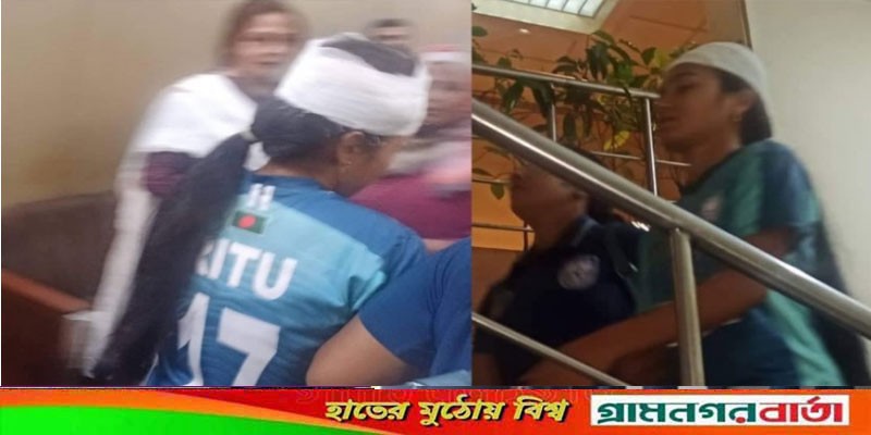 ছাদখোলা বাসে আহত ঋতুপর্ণা, লেগেছে তিনটি সেলাই! ছাদখোলা বাসে আহত ঋতুপর্ণা, লেগেছে তিনটি সেলাই!