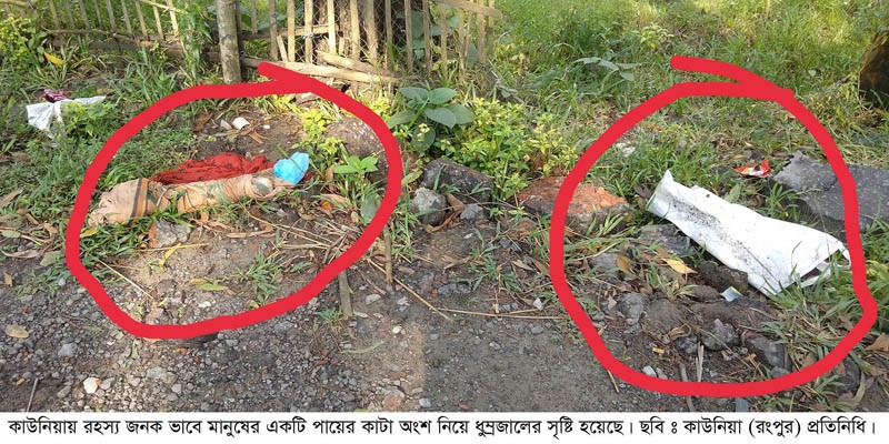 কাউনিয়ায় মানুষের কাটা পা নিয়ে ধৃম্রজাল কাউনিয়ায় মানুষের কাটা পা নিয়ে ধৃম্রজাল