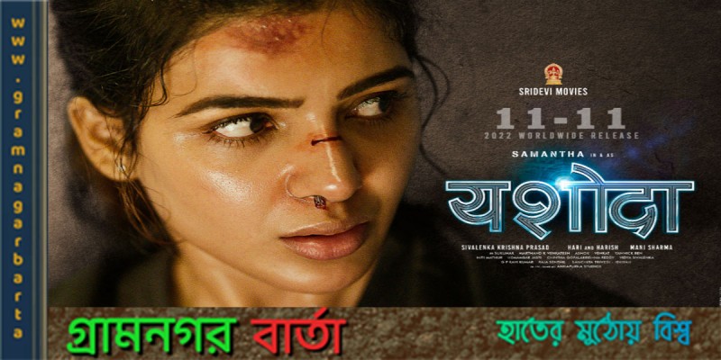 যশোধার ট্রেলারের পরই বিরল রোগের প্রকাশ যশোধার ট্রেলারের পরই বিরল রোগের প্রকাশ