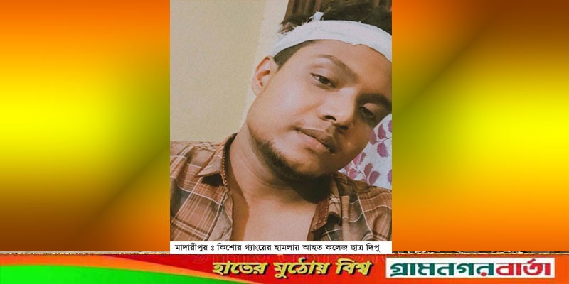 কলেজ ছাত্রের উপর কিশোর গ্যাংয়ের হামলার ৭দিন পর মামলা রেকর্ড কলেজ ছাত্রের উপর কিশোর গ্যাংয়ের হামলার ৭দিন পর মামলা রেকর্ড