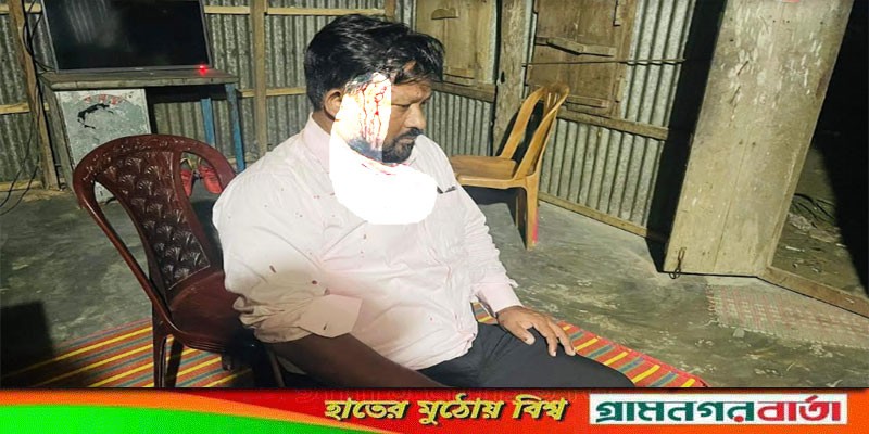মাদারীপুরে স্বেচ্ছাসেবকদলের নেতাদের উপর হামলা, জেলা সম্পাদকসহ আহত ১০ মাদারীপুরে স্বেচ্ছাসেবকদলের নেতাদের উপর হামলা, জেলা সম্পাদকসহ আহত ১০
