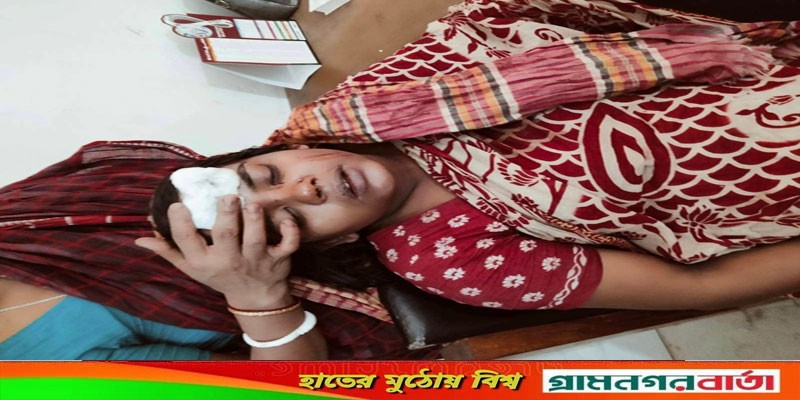 ডাসারে দিনদুপুরে বসতবাড়িতে দূর্বৃত্তদের ডাকাতি, অন্তঃসত্বা নারীসহ আহত-২ ডাসারে দিনদুপুরে বসতবাড়িতে দূর্বৃত্তদের ডাকাতি, অন্তঃসত্বা নারীসহ আহত-২